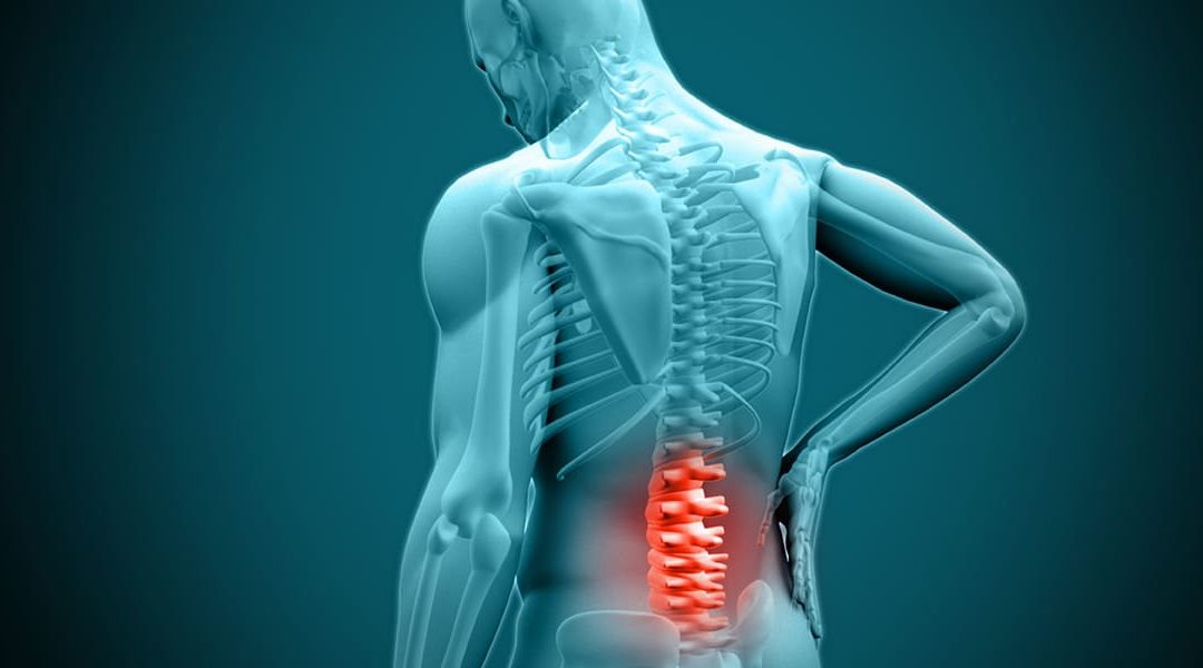 Suffering From a Herniated Disc?
