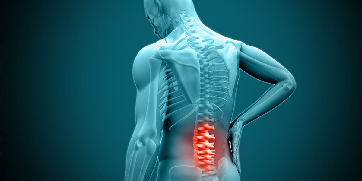 Spine Condition - Herniated Disc