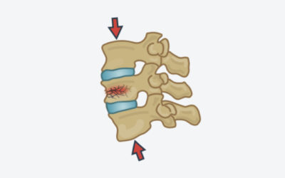 Pain in the Neck and Lower Back